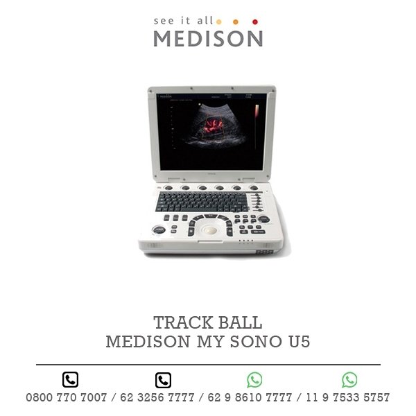 TRACK BALL ULTRASSOM MEDISON MY SONO U5